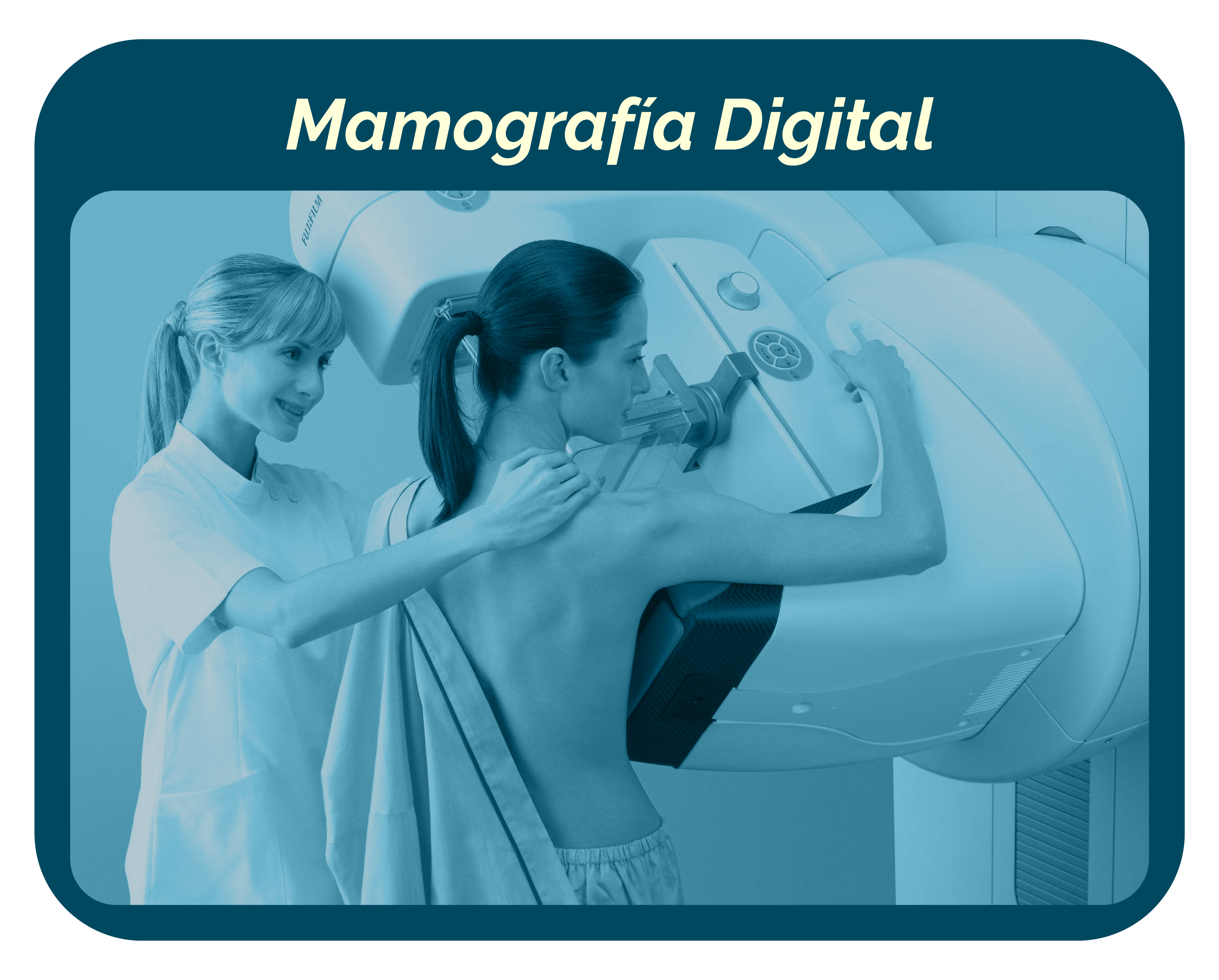 Mamografía Digital